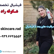 فیشیال شکوفه راد