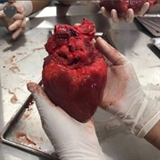 گرگ خاکستری