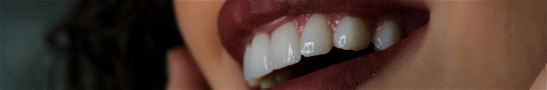 کلینیک دندانپزشکی زیبایی چاوش